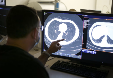 Fármaco aprobado para cáncer de páncreas muestra resultados prometedores contra tumores pulmonares
