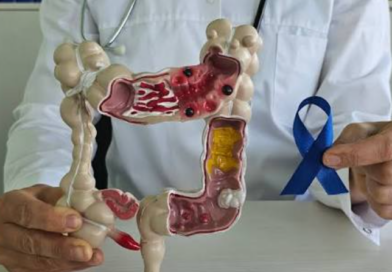 La señal al ir al baño que muchos pasan por alto y podría advertir sobre cáncer colorrectal