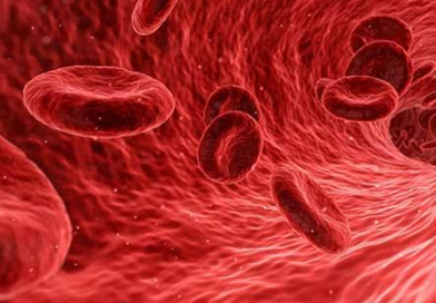 Estudio encuentra resultados prometedores de la vitamina C en trastornos precancerosos de la sangre